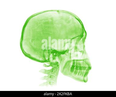 Menschlicher Schädel. Grünes Röntgenbild auf weißem Hintergrund Stockfoto