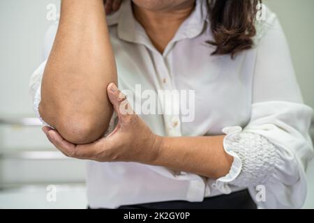 Asiatische Dame Frau Patientin berühren und fühlen Schmerzen ihren Ellbogen und Arm, gesunde medizinische Konzept. Stockfoto