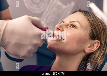 Zahnärzte untersuchen die Farbe der Zähne Stockfoto