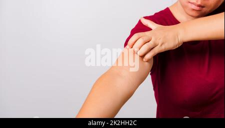 Eine wunderschöne asiatische Frau juckt sich und kratzt ihren juckenden Arm Stockfoto