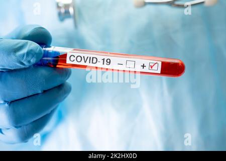 Positive Blutinfektionsprobe im Reagenzglas für covid19 Coronaviren im Labor. Wissenschaftler hält an, um den Patienten im Krankenhaus zu überprüfen und zu analysieren. Stockfoto