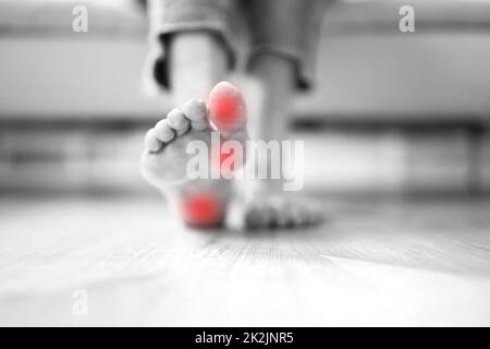 Fussfersenschmerzen Und Callus Care Closeup Stockfoto