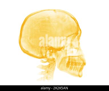 Menschlicher Schädel. Gelbes Röntgenbild auf weißem Hintergrund Stockfoto