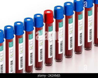Blutproben in Fläschchen mit HIV-Testetiketten auf weißem Hintergrund isoliert. 3D Abbildung Stockfoto