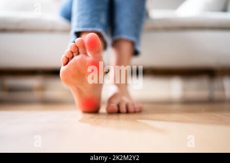 Fussfersenschmerzen Und Callus Care Closeup Stockfoto