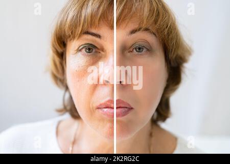 Frau mit Vor und Nach der Verjüngung Stockfoto