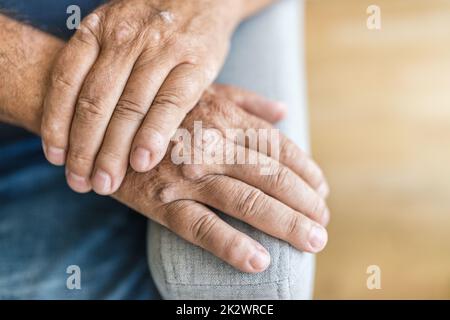 Alter Mann mit Psoriasis an den Händen Stockfoto