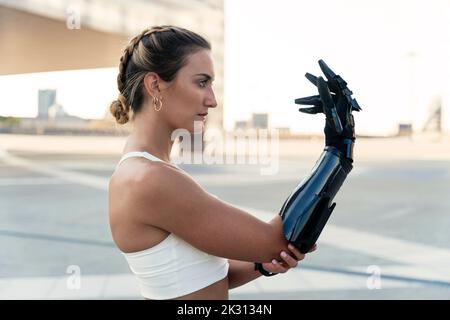 Schöne junge Frau, die auf Armprothese schaut Stockfoto