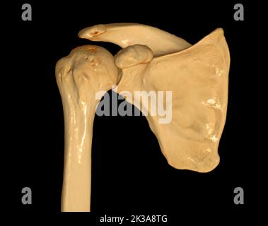 CT Shoulder 3D der Computertomographie Volumen-Rendering-Untersuchung der Schulter 3D mit Darstellung im Fall einer Fraktur des Schultergelenks. Stockfoto