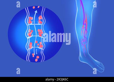 Anatomische 3D Darstellung von inkompetenten Venen und Krampfadern in den Beinen. Transparentes Kreislaufsystem der Venen. Stockfoto