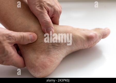 Eine Person, die das Fußknöchelgelenk massiert und an Arthritis leidet. Stockfoto
