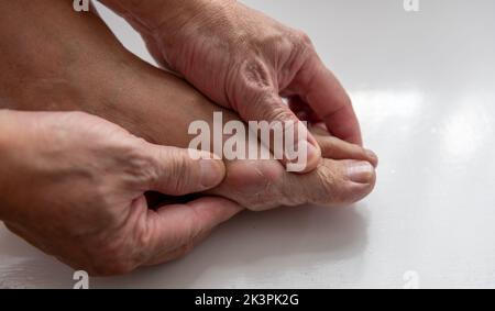 Eine Person, die an Gicht-Schmerzen im Zehengelenk leidet. Stockfoto