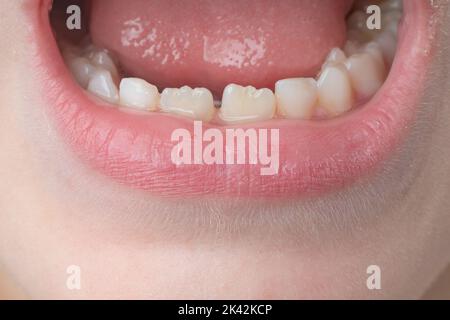 Kiefer mit geraden Zähnen des Kindes Nahaufnahme, Milch und dauerhafte Zähne bei einem Kind. Stockfoto