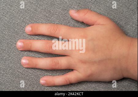 Schmutzige und schlampig getrimmte Fingernägel, Finger und Zehennägel des Kindes in Nahaufnahme, Finger des kleinen Kindes auf grauem Hintergrund. Stockfoto