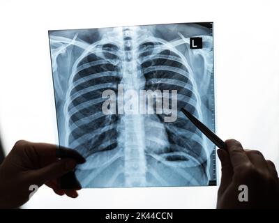 Arzt zeigt Röntgenaufnahme der Lunge des Patienten. Stockfoto