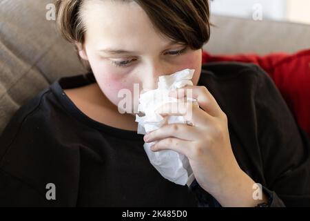 Ein unwohl kranker Jugendlicher, der auf einer Couch liegt und Gewebe an seine Nase hält, seine Wangen sind von einem Fieber rot Stockfoto