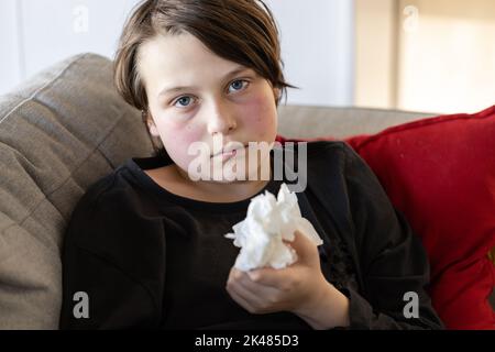 Ein unwohl kranker, jugendlicher Junge, der auf einer Couch liegt und die Kamera anschaut, der ein paar gebrauchte Tücher hält, seine Wangen sind von einem Fieber rot Stockfoto