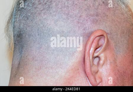 Nahaufnahme eines Mannes mittleren Alters auf dem Hintergrund kurzgeschnittenes Kopfhaar Stockfoto