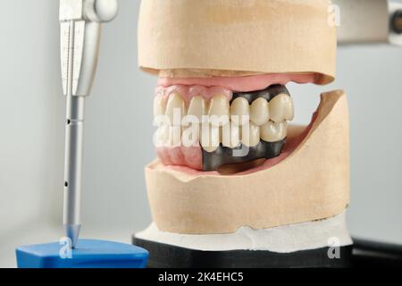 Zahnärztliche Aufnahme des Artikulators und zwei Zahnprothesen im Okklusion für Genauigkeit und Messungen. Das Konzept der Prothetik und Implantologie. Stockfoto