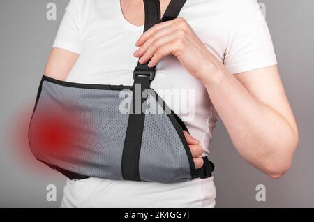 Ellenbogenschmerzen nach Trauma. Verletzte Hand, Arm in orthopädischer Hebegurte. Hochwertige Fotos Stockfoto