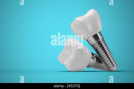 Zahnimplantate auf blauem Hintergrund. 3D Rendern. Stockfoto