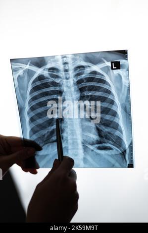 Arzt zeigt Röntgenaufnahme der Lunge des Patienten. Stockfoto