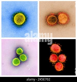 Eine Zusammenstellung von Bildern des neuartigen Coronavirus SARS-CoV-2. Transmissions-Elektronenmikrographie eines SARS-CoV-2-Virus-Partikels, isoliert von einem Patienten. Eine optimierte und verbesserte, einzigartige Composite-Version von vier Rasterelektronenmikrographen-Bildern, Quelle: NIAID Stockfoto