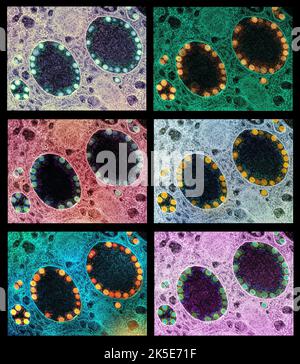 Neuartige Coronavirus-SARS-CoV-2-Viruspartikel. Eine einzigartige Kombination aus 6 Transmissionselektronenmikrographen-Bildern von SARS-CoV-2-Viruspartikeln innerhalb von Endosomen einer stark infizierten nasalen olfaktorischen Epithelzelle. Bilder, die in der NIAID Integrated Research Facility aufgenommen wurden. Eine optimierte und verbesserte, einzigartige Composite-Version von 6 Rasterelektronenmikrographen-Bildern, Quelle: NIAID / Alamy Live News Stockfoto