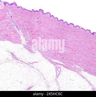 Mikroskopmikroskop mit geringer Leistung von dünner Haut, die von oben nach unten, die Epidermis, eine sehr dicke Dermis mit Schweißdrüsen und die Adipos zeigt Stockfoto