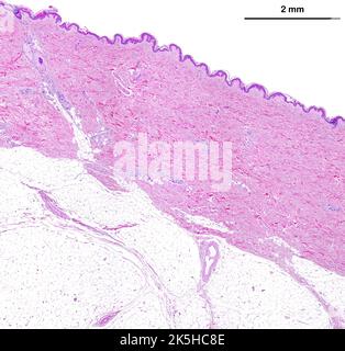 Mikroskopmikroskop mit geringer Leistung von dünner Haut, die von oben nach unten, die Epidermis, eine sehr dicke Dermis mit Schweißdrüsen und die Adipos zeigt Stockfoto