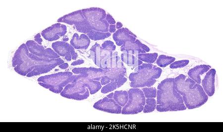 Mikroskopmikroskop mit geringer Leistung einer mit HE gefärbten menschlichen Thymusdrüse. Das Thymian-Parenchym besteht aus Lobeln, die durch Adipose Tissu getrennt sind Stockfoto