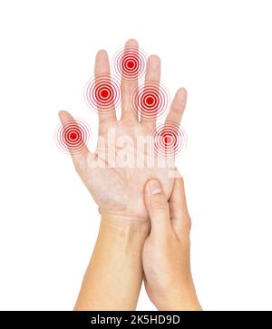 Entzündung mehrerer Gelenke. Konzept und Idee von rheumatischer Arthritis, Polyarthritis, Schwellung der Handgelenke oder Arthralgie. Stockfoto