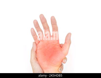 Schmerzhafter Palmar-Aspekt des asiatischen jungen Mannes. Konzept des Kompartiment-Syndroms, Zellulitis und Schmerzen der Handmuskulatur. Stockfoto