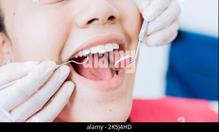 Hände eines Zahnarztspezialisten, der die Zähne einer weiblichen Patientin reinigt. Nahaufnahme der Hände des Zahnarztes, die den Patienten reinigen. Nahaufnahme der Hände eines Zahnarztes Stockfoto