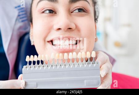 Zahnarzt hält eine Reihe von Implantaten mit verschiedenen Tontönen. Patient, der den Farbton des Zahnimplantats auswählt. Auswahl der Zahnfarbe für Implantate, Zahnarzt Stockfoto