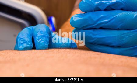 Eine Nahaufnahme der Hände eines Arztes mit blauen Handschuhen, die einen Nadelschuss geben Stockfoto