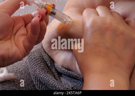 Frau injiziert mit einer Spritze Hormone in den Bauch. Nahaufnahme des IVF-Konzepts. Stockfoto