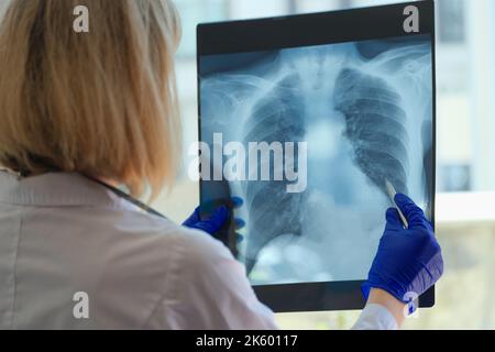 Doktor Pneumologe, der Röntgenaufnahmen der Lunge betrachtet Stockfoto