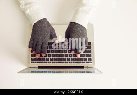 Mann mit rheumatoider Arthritis, der an einem Laptop arbeitet und Kompressionshandschuhe trägt, um Schmerzen zu lindern Stockfoto