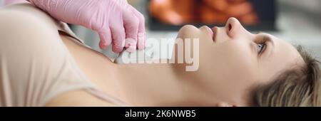 Hände des Arztes am Hals der Frau, Ultraschall Schilddrüse Stockfoto