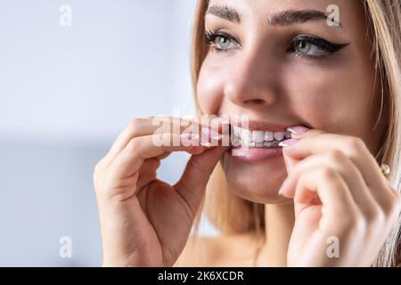 Eine Frau zieht einen unsichtbaren Zahnausrichter aus Silikon an. Zahnspangen für die Zahnkorrektur. Stockfoto