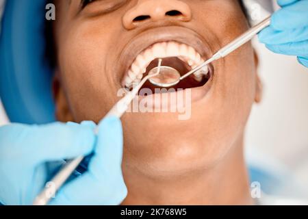 Offen weit für mich bitte. Eine junge Patientin, die ihre Zähne untersuchen ließ. Stockfoto