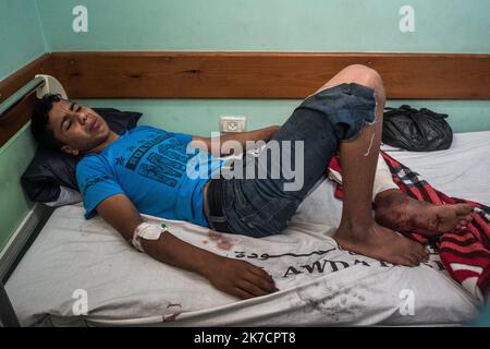 ©Michael Bunel / Le Pictorium/MAXPPP - Michael Bunel / Le Pictorium - 14/05/2018 - Palästina / Bande de Gaza / Malaka - Montser Raed Hania, 16 ans, est entre a l'hopital Al-Awda apres avoir ete blesse lors d'affrontements avec les forces israeliennes pres de la frontiere entre Gaza et Israel. Le 14 Mai 2018. Bande de Gaza, Palästina / 14/05/2018 - Palästina / Gazastreifen / Malaka - Montser Raed Hania, 16, kam in das Al-Awda-Krankenhaus, nachdem er bei Zusammenstößen mit israelischen Streitkräften in der Nähe der Grenze zwischen Gaza und Israel verletzt worden war. 14.Mai 2018. Gazastreifen, Palästina Stockfoto