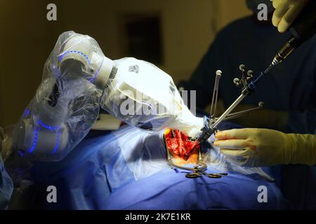 ©PHOTOPQR/OUEST FRANKREICH/Eddy LEMAISTRE ; ANGERS ; 01/06/2021 ; Chirurgie du rachis avec utilization du bras robotisé par le Dr Rogatien Faguer , neurochirurgien au CHU d’Angers . Le CHU d’Angers vient de se dotter d’une Suite chirurgicale robotisée de pointe Loop-X . Inédite en Europe et d’un montant de plus d’un million d’Euros elle permet des gestes opératoires à haut risque de séquelles imposant précision du chirurgien et sécurisation de la pry en Charge comme la Chirurgie de la colonne vertébrale, biopsie profonde du tronc cérébral, chirurgie de l’épilepsie chez l’adulte et l’enfant, opérati Stockfoto