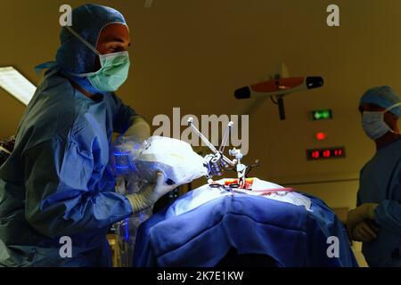 ©PHOTOPQR/OUEST FRANKREICH/Eddy LEMAISTRE ; ANGERS ; 01/06/2021 ; Chirurgie du rachis avec utilization du bras robotisé par le Dr Rogatien Faguer , neurochirurgien au CHU d’Angers . Le CHU d’Angers vient de se dotter d’une Suite chirurgicale robotisée de pointe Loop-X . Inédite en Europe et d’un montant de plus d’un million d’Euros elle permet des gestes opératoires à haut risque de séquelles imposant précision du chirurgien et sécurisation de la pry en Charge comme la Chirurgie de la colonne vertébrale, biopsie profonde du tronc cérébral, chirurgie de l’épilepsie chez l’adulte et l’enfant, opérati Stockfoto