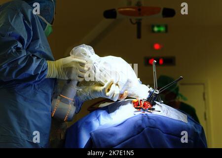 ©PHOTOPQR/OUEST FRANKREICH/Eddy LEMAISTRE ; ANGERS ; 01/06/2021 ; Chirurgie du rachis avec utilization du bras robotisé par le Dr Rogatien Faguer , neurochirurgien au CHU d’Angers . Le CHU d’Angers vient de se dotter d’une Suite chirurgicale robotisée de pointe Loop-X . Inédite en Europe et d’un montant de plus d’un million d’Euros elle permet des gestes opératoires à haut risque de séquelles imposant précision du chirurgien et sécurisation de la pry en Charge comme la Chirurgie de la colonne vertébrale, biopsie profonde du tronc cérébral, chirurgie de l’épilepsie chez l’adulte et l’enfant, opérati Stockfoto