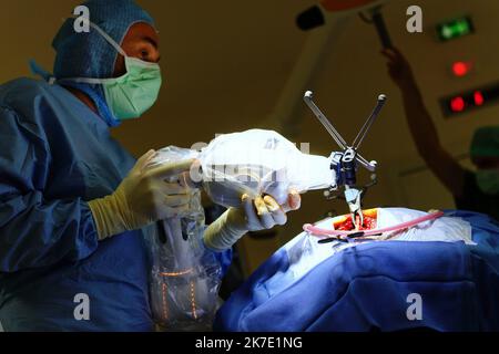 ©PHOTOPQR/OUEST FRANKREICH/Eddy LEMAISTRE ; ANGERS ; 01/06/2021 ; Chirurgie du rachis avec utilization du bras robotisé par le Dr Rogatien Faguer , neurochirurgien au CHU d’Angers . Le CHU d’Angers vient de se dotter d’une Suite chirurgicale robotisée de pointe Loop-X . Inédite en Europe et d’un montant de plus d’un million d’Euros elle permet des gestes opératoires à haut risque de séquelles imposant précision du chirurgien et sécurisation de la pry en Charge comme la Chirurgie de la colonne vertébrale, biopsie profonde du tronc cérébral, chirurgie de l’épilepsie chez l’adulte et l’enfant, opérati Stockfoto