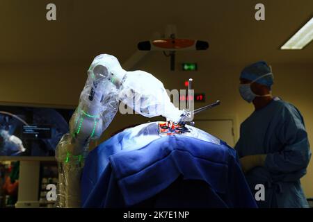 ©PHOTOPQR/OUEST FRANKREICH/Eddy LEMAISTRE ; ANGERS ; 01/06/2021 ; Chirurgie du rachis avec utilization du bras robotisé par le Dr Rogatien Faguer , neurochirurgien au CHU d’Angers . Le CHU d’Angers vient de se dotter d’une Suite chirurgicale robotisée de pointe Loop-X . Inédite en Europe et d’un montant de plus d’un million d’Euros elle permet des gestes opératoires à haut risque de séquelles imposant précision du chirurgien et sécurisation de la pry en Charge comme la Chirurgie de la colonne vertébrale, biopsie profonde du tronc cérébral, chirurgie de l’épilepsie chez l’adulte et l’enfant, opérati Stockfoto