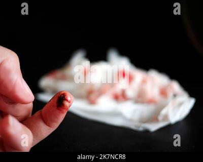 Nahaufnahme weiblicher linker Ringfinger wurde mit einem Messer geschnitten, verletzte, blutige Finger, die Wunde wurde mit flüssigem Gelputz überzogen. Mit verschwommenem gebrauchten zerknittert Stockfoto