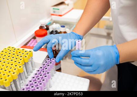 Viele Boxen mit Laborröhrchen in der Klinik. Ein Laborant arbeitet in einem Forschungslabor mit Reagenzgläsern. Die Hand eines Arztes in einem Prote Stockfoto